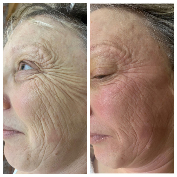 Réalisation de soins du visage anti-âge Visible Age Reverse à Strazeele